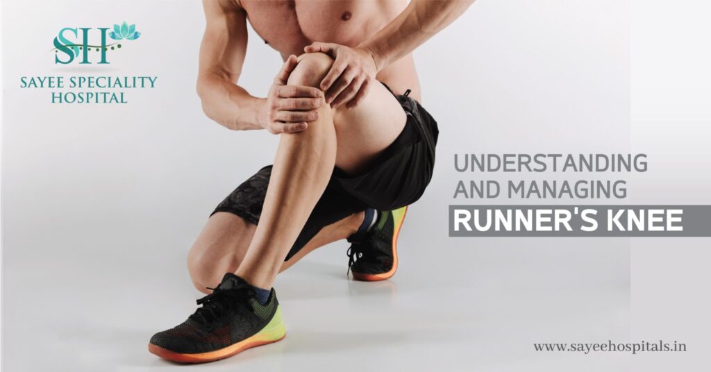 Understanding and Managing Runner's Knee