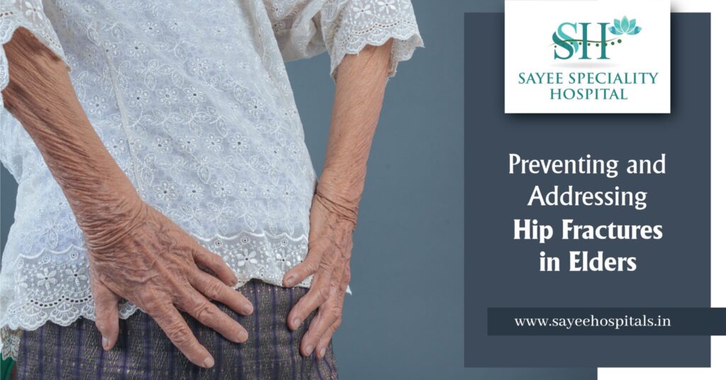 Preventing and Addressing Hip Fractures in Elders