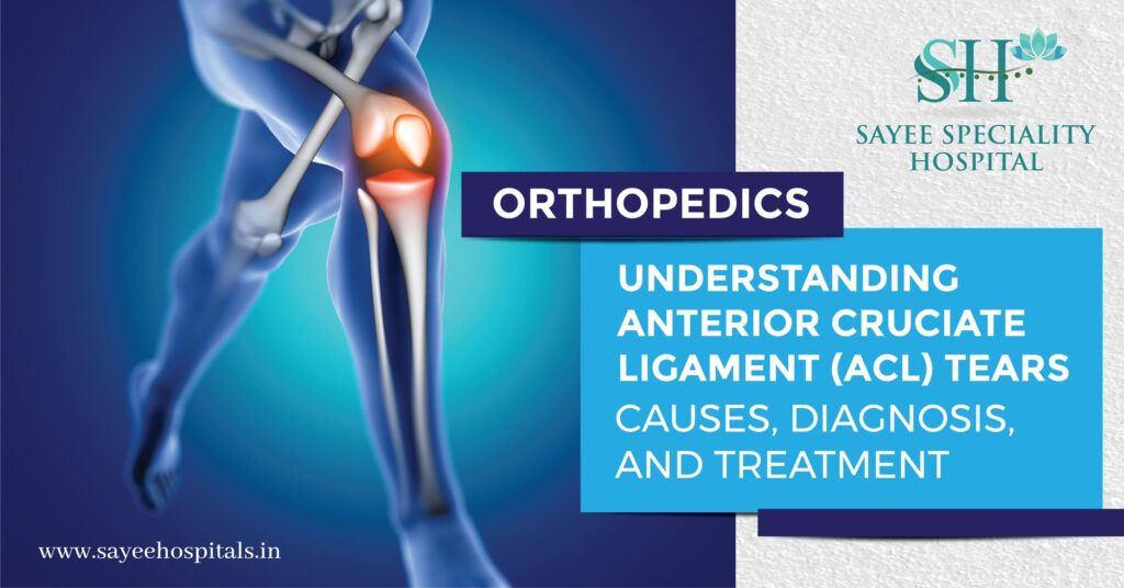 Understanding Anterior Cruciate Ligament Tears Causes, Diagnosis And Treatment