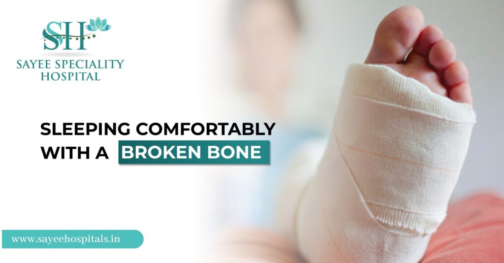 Sleeping Comfortably With A Broken Bone