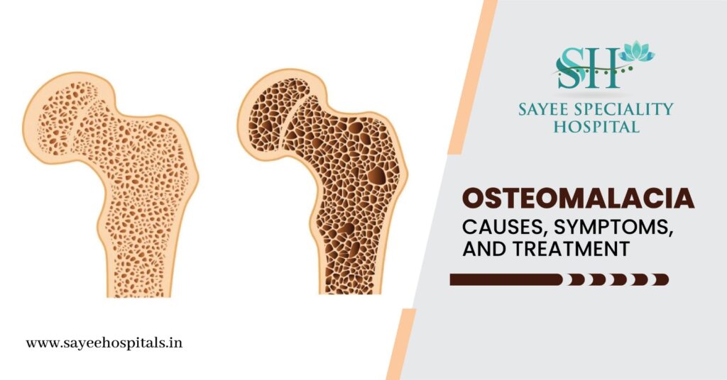 Osteomalacia Causes Symptoms And Treatment