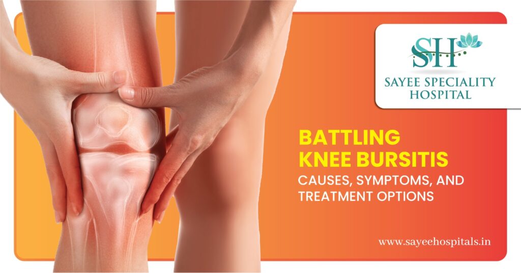 Battling Knee Bursitis Causes Symptoms And Treatment Options