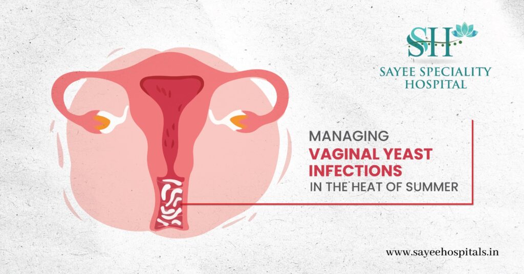 MANAGING VAGINAL YEAST INFECTIONS IN THE HEAT OF SUMMER