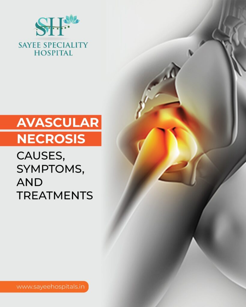 Avascular Necrosis Causes Symptoms And Treatments