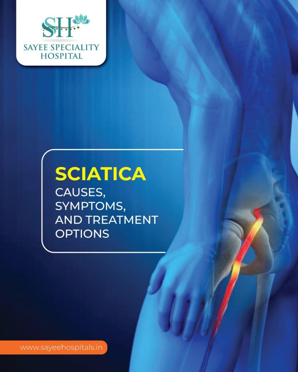 Sciatica Causes, Symptoms And Treatment Options