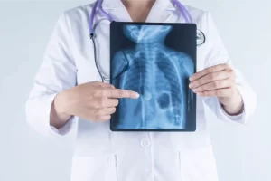 Pulmonology Scan