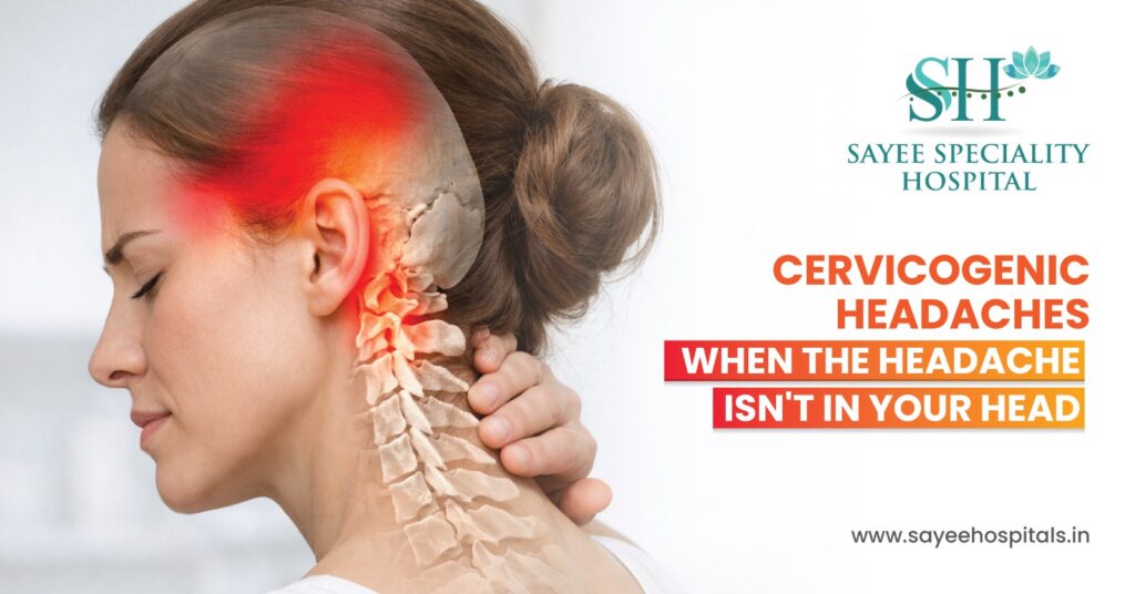 Cervicogenic Headaches: When The Headache Isn’t In Your Head