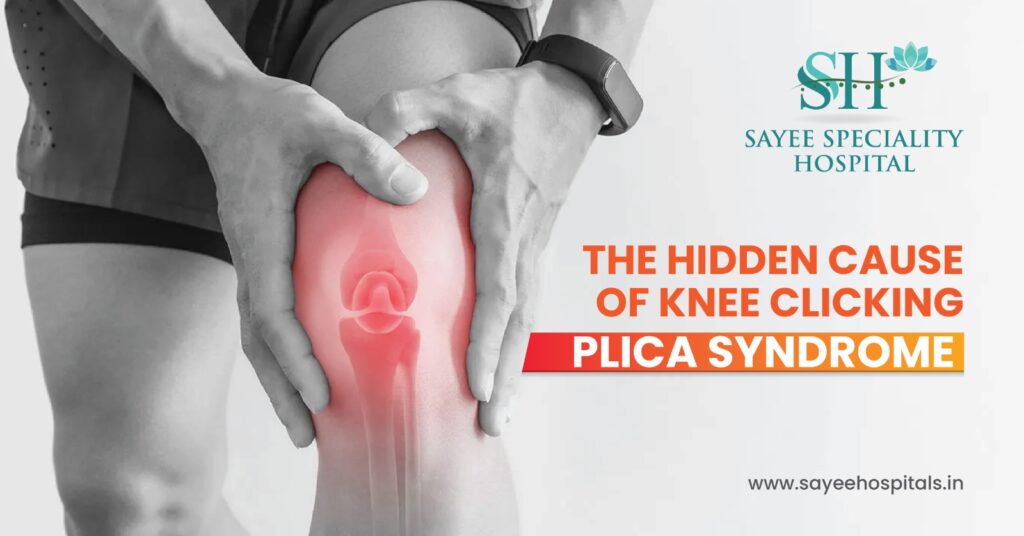 The Hidden Cause Of Knee Clicking : Plica Syndrome