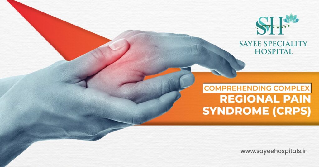 Comprehending Complex Regional Pain Syndrome (CRPS)