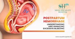 Postpartum Hemorrhage Understanding And Managing Excessive Bleeding.