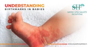 Understanding Birthmarks in Babies