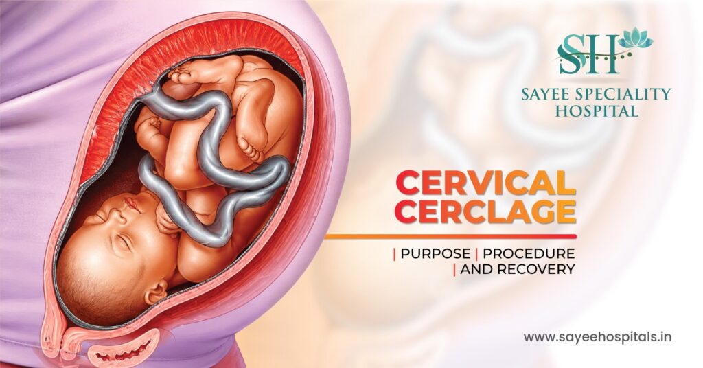 Cervical Cerclage: Purpose, Procedure & Recovery