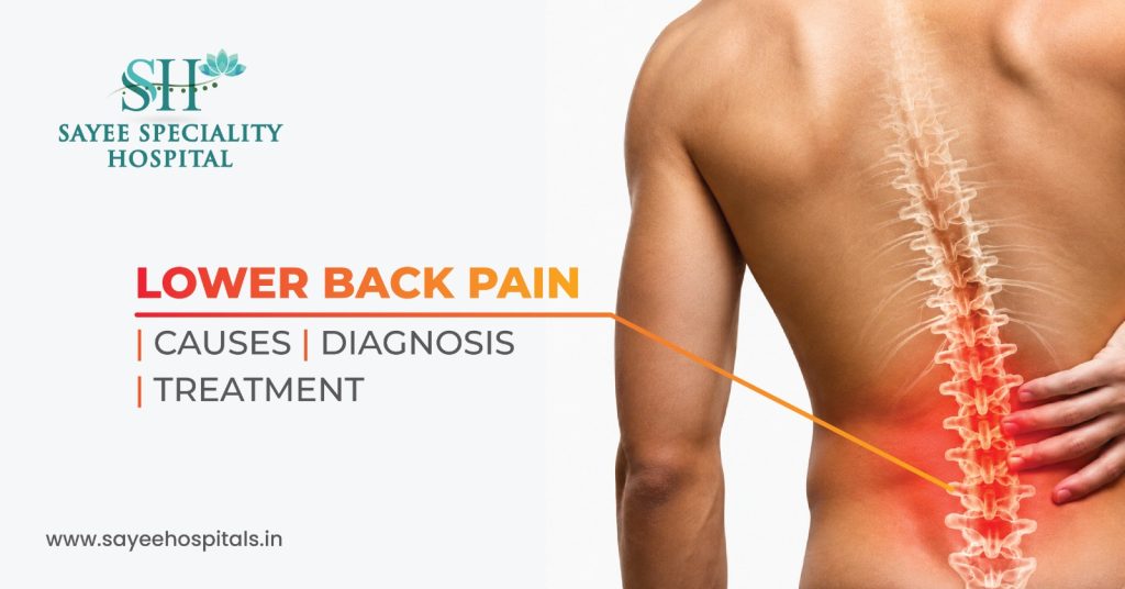 Lower Back Pain Causes, Diagnosis, and Treatment