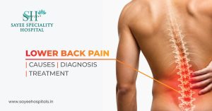 Lower Back Pain Causes, Diagnosis, and Treatment